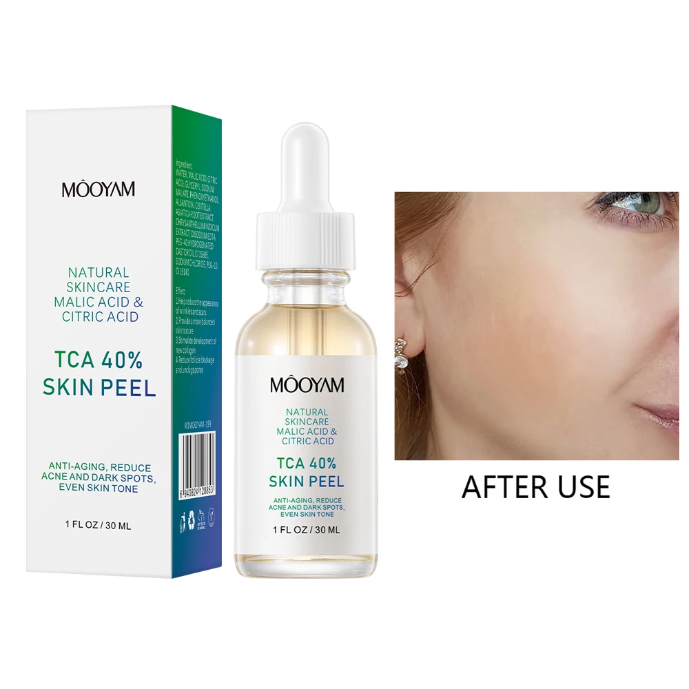 Chemical Peeling Solution TCA 40% Moisturizing Essence Glowing Skin Facial Exfoliant Pore Cleansing Serum