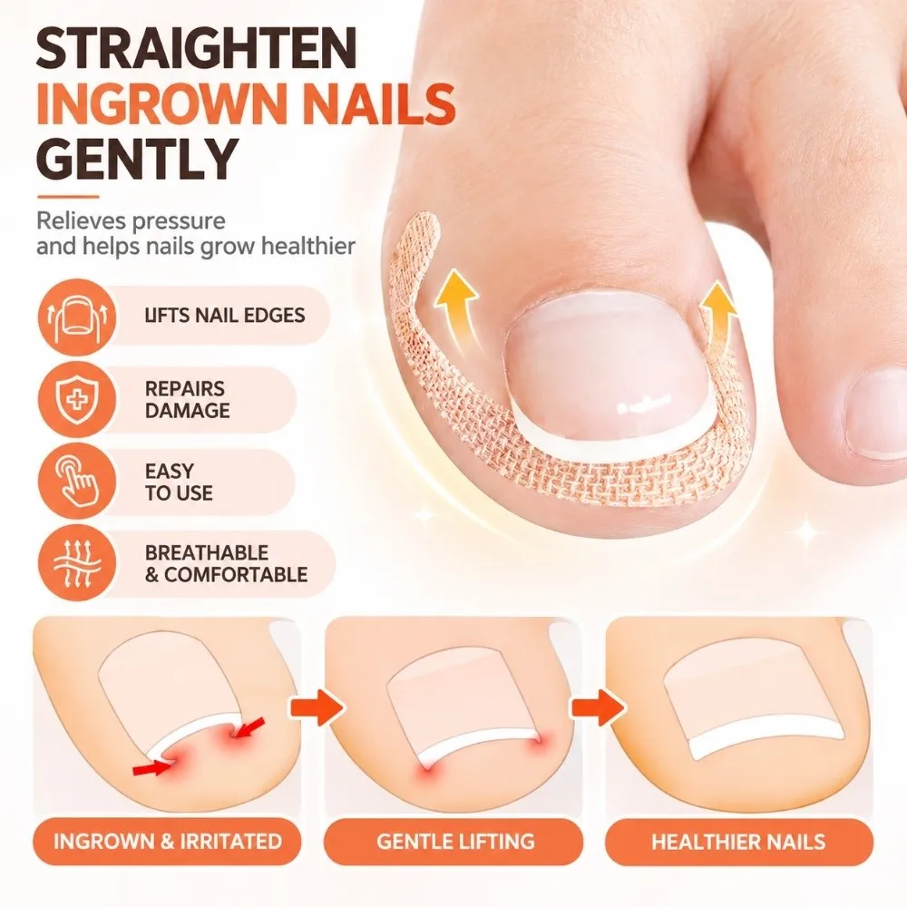 6PCS Flexible Ingrown Toenail Correction Patch Glue-Free Application Breathable Nonwoven Fabric Nail Groove Corrector Strip