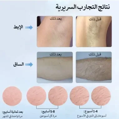 MLAY Factory T4 IPL الشعر المحمولة للاستخدام المنزلي جهاز إزالة الشعر التكنولوجيا إعادة شحن المملكة المتحدة آلة الوجه Sonophoresis شنتشن سريع