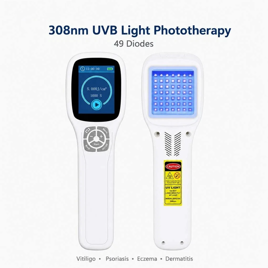 49 Diodes 308nm Narrow Band UVB Handheld Phototherapy Device Rechargeable Targeted Light Therapy Vitiligo Psoriasis Dermatitis
