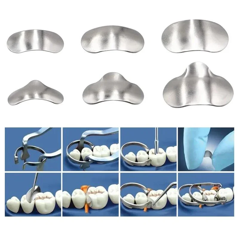 

Dental Matrix Sectional Contoured Metal Bands and Rings for Teeth Replacement Oral Care Professional Use