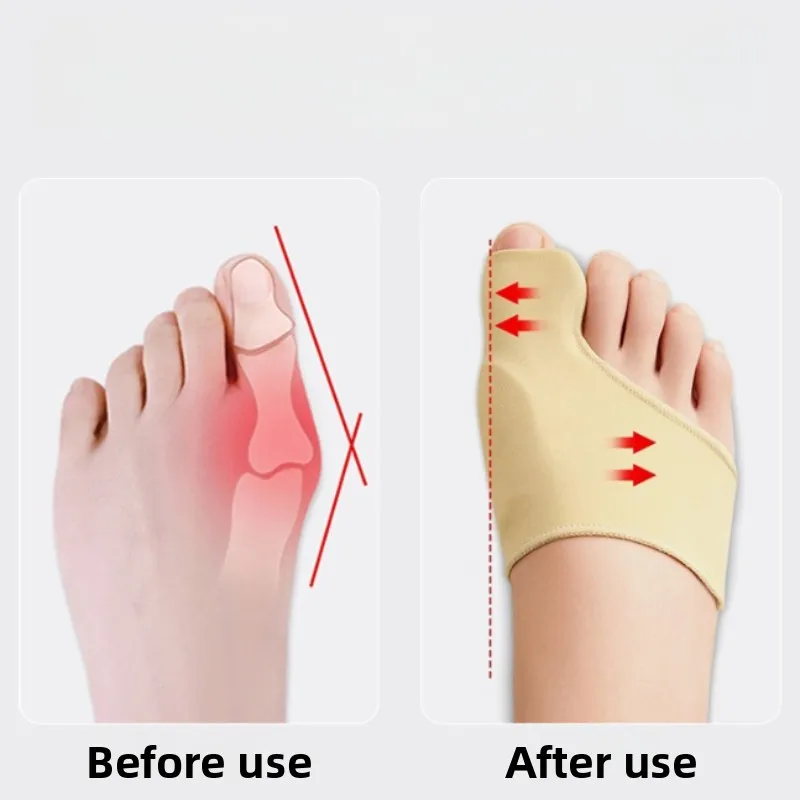 2 قطعة فاصل أصابع القدم جورب مستقيم أروح الورم مصحح تقويم العظام قدم العظام الإبهام الضابط تصحيح أدوات باديكير #2