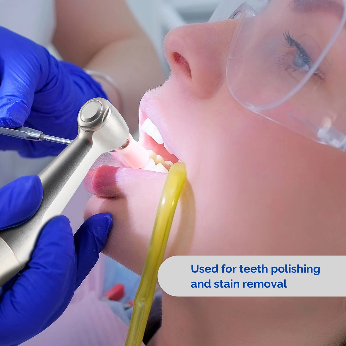 

100 шт./кор. AZDENT стоматологическая полировка Prophy Cup стоматологический силиконовый полировщик комплект RA 2,35 мм для низкоскоростного наконечника для полировки зубов