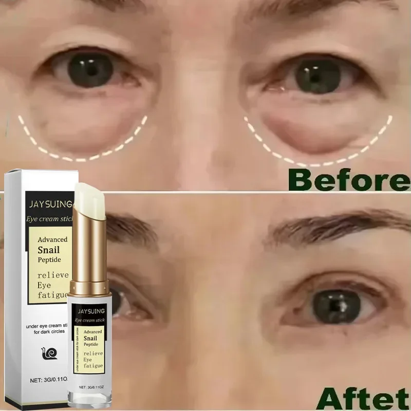 

Instant Eye Bag Removal Cream Retinol Anti-Wrinkle Firming Skin Fade Fine Lines Anti Dark Circle Puffiness Brighten Eye Care