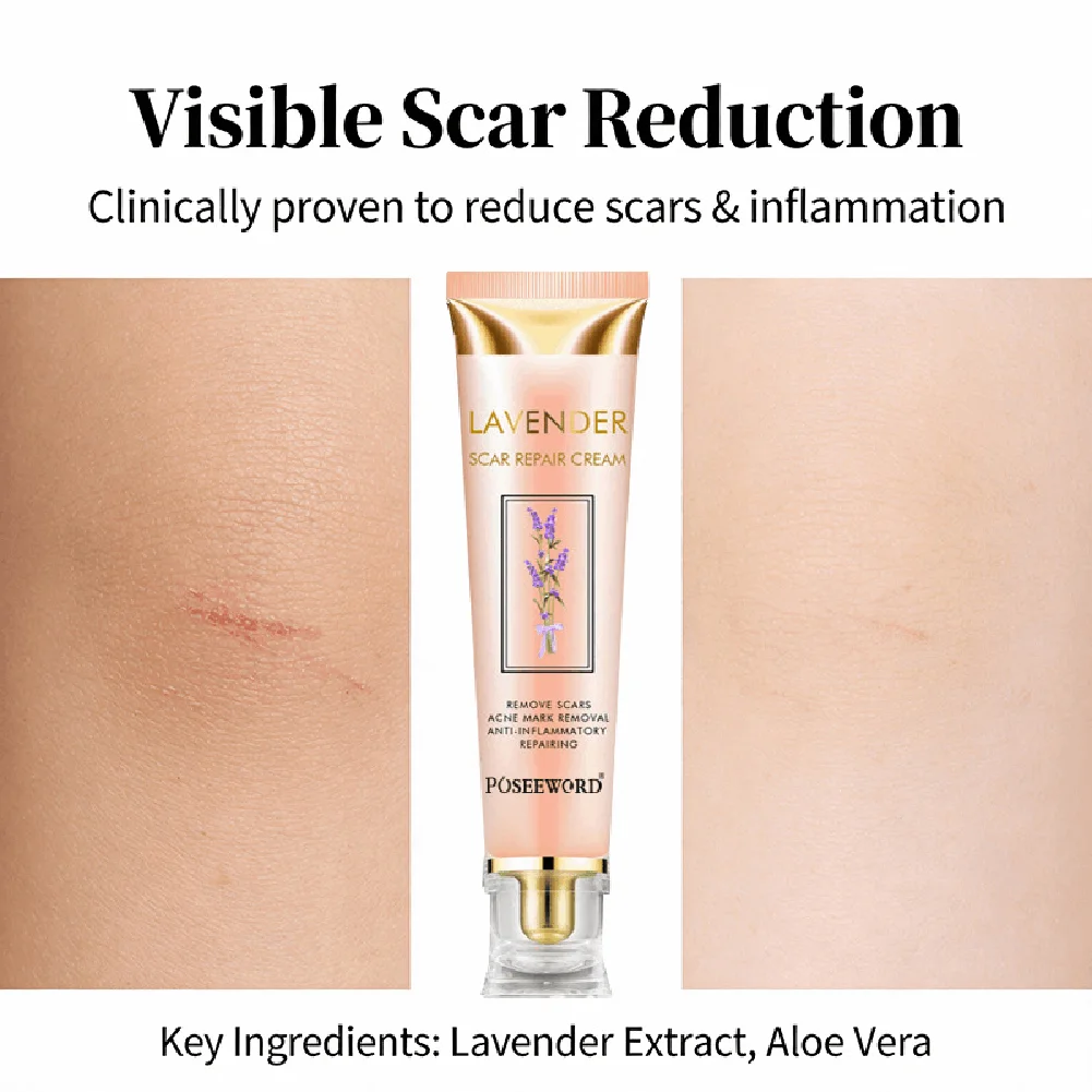 

1/3PCS Yoxier Lavender Scar Repair Cream Softening Proliferating Stratum Corneum Removes Pigmentation Scars Promote Absorption