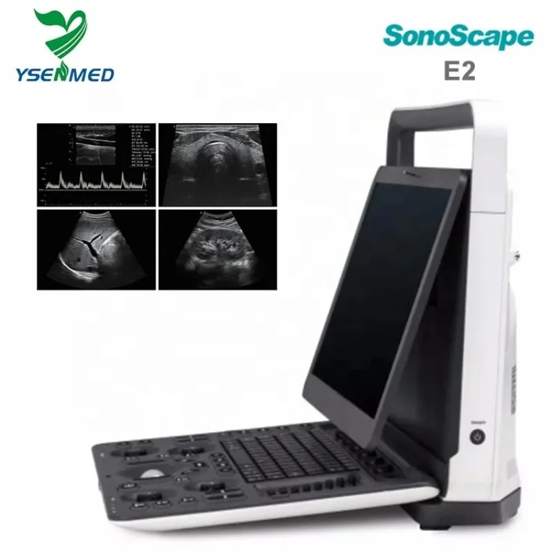 Sonoscape E2 Portable Color Doppler Ultrasound Machine