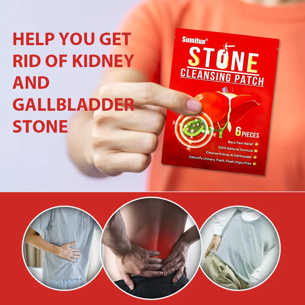 6pcs Kidney Stone Clean Patch Treat Gallstones Renal Calculus Medicinal Patches Urolithiasis Detoxification Pain Relief Stickers