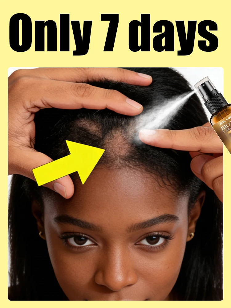 

Нежный спрей для людей, страдающих истончением волос на макушке.