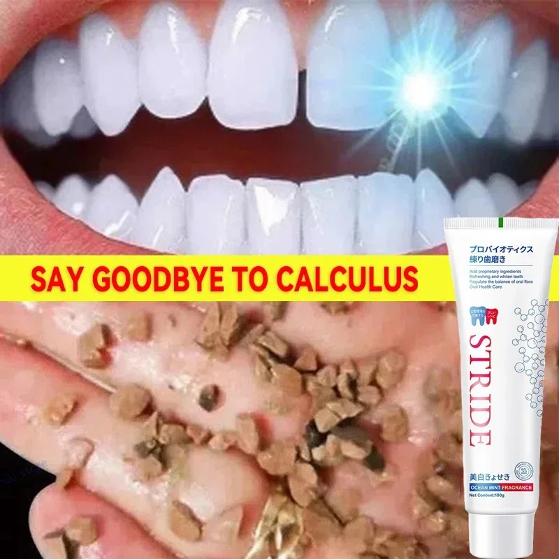 

100g Dental Calculus Removal Toothpaste Teeth Whitening Remove Stains Bad Breath Preventing Periodontitis Dental Cleansing Care