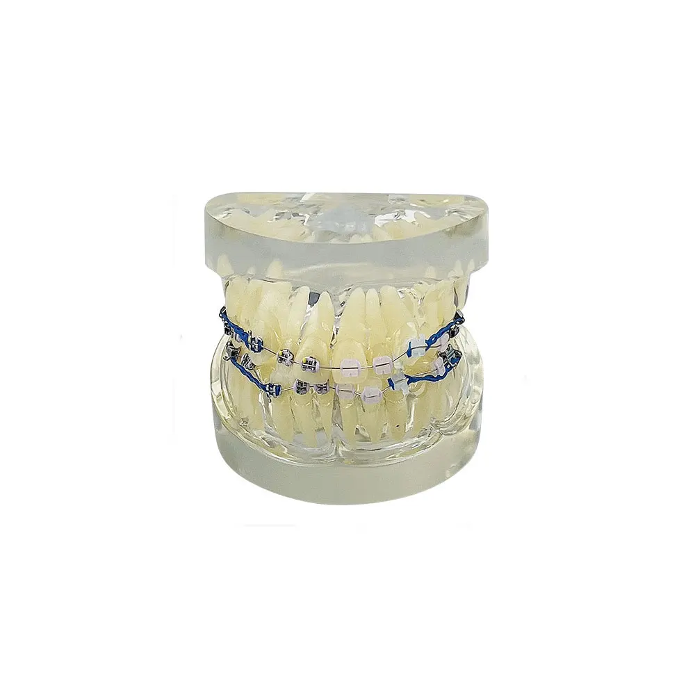 Orthodontic Dental Treatment Teeth Model Teaching Study Gum Tooth Models With Ortho Metal Bracket Arch Wire Ligature Ties Dentis