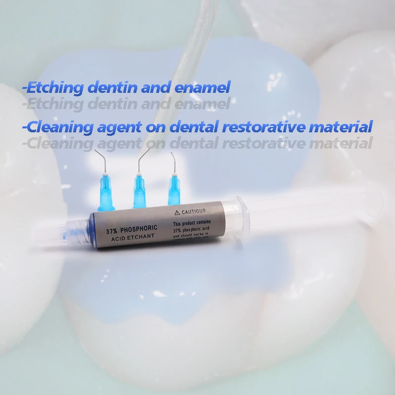 Gel de grabado azul de ácido fosforico 37% Dental para tratar el esmalte de la dentina, grabado modificado, pretratamiento, herramienta de dentista