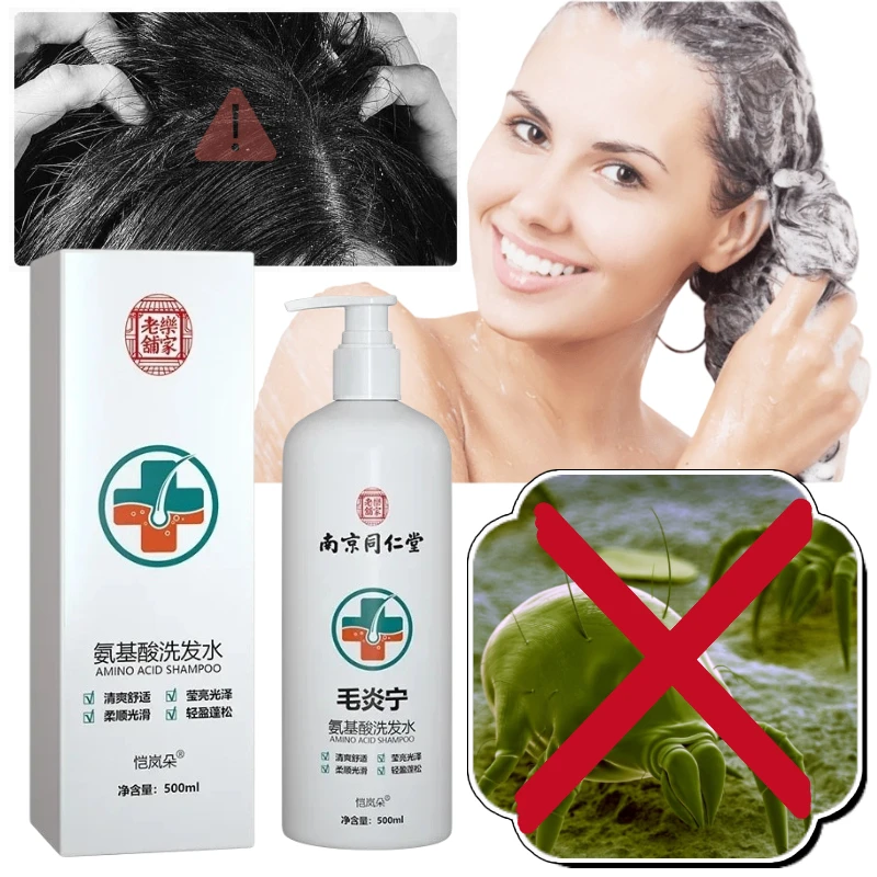 Hair Inflammation Amino Acid Ning Shampoo Dew Repair Hair Follicle Plant Mite Removal Hair Cream Damage Repair Improve Frizz