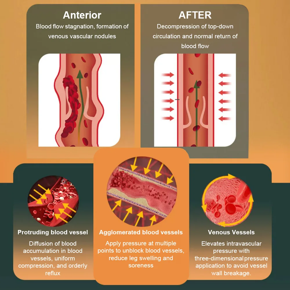 جوارب ضغط طبية مفتوحة من Cofoe للرجال والنساء ، الدوالي ، جوارب السكري ، مستوى 2 ، 1 زوج