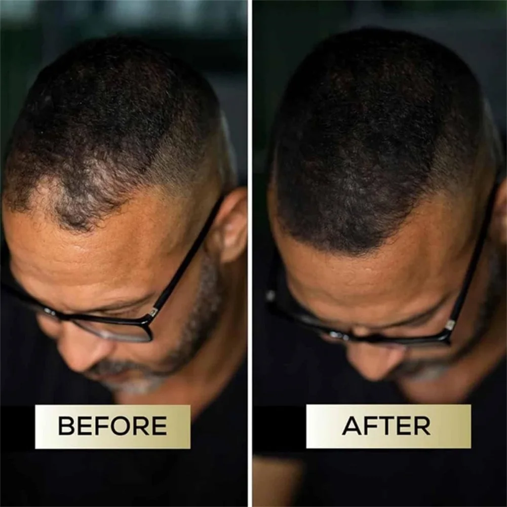 50ml Hair Concealer Cream Waterproof Sweat-Proof Natural Cover Unisex Hairline Shadow Makeup For fuller Bald Thinning Hair