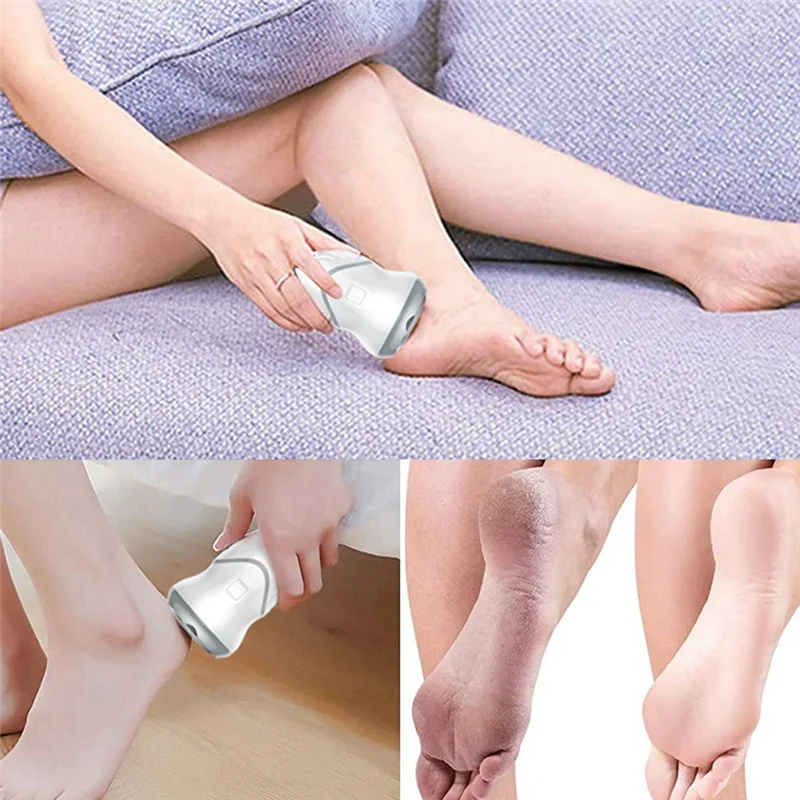 

【Ценная цена!】Профессиональная электрическая мозоли для удаления мозолей на ногах, моющаяся USB-перезаряжаемая шлифовальная машина для ног, шлифовальная машина для ног с вакуумным всасыванием