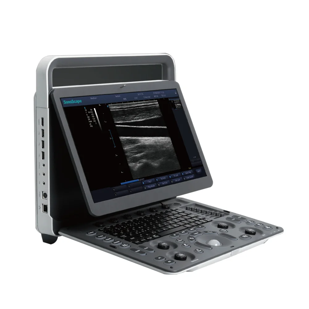 Medical Diagnostic Equipment Portable ultra sound scan B/W Ultrasound Machines