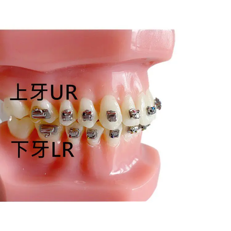 Dental 6th Generation KND Self-Ligating Bracket - MBT Straight Wire Mini Mesh Base Full Mouth Teeth Correction Orthodontic Brack