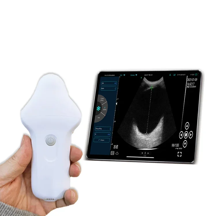 Suresult Portable Handheld Eye Ultrasound Machine for Precise Ocular Imaging