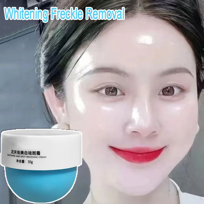 Отбеливающий крем от веснушек, удаление темных пятен, крем против веснушек, крем для лица, ниацинамид, выцветание пигментации, мелазма, осветляющий уход за кожей, 30 г