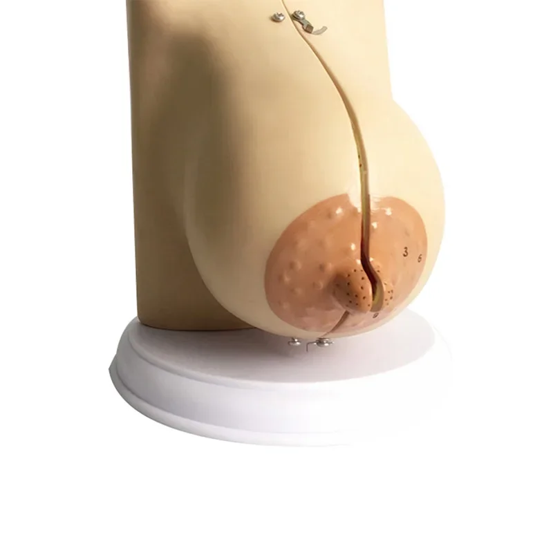 Breast Lesion Model Human Female Quiescent Breast Anatomy Model Environmentally Friendly Medical Teaching Display Model