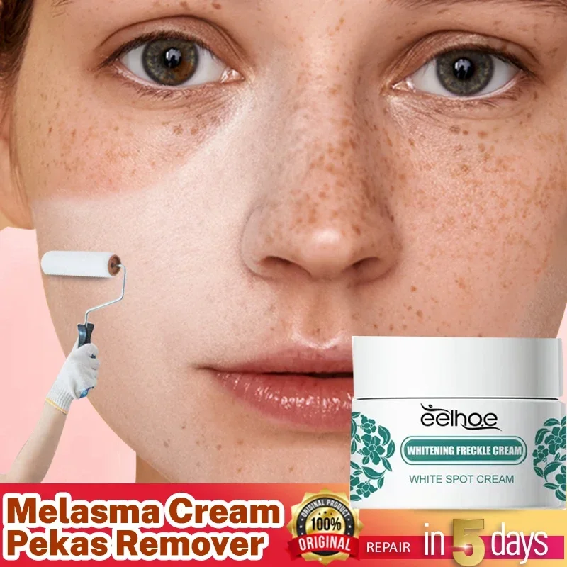 Whitening Frckle Freckles Brighten Facial Skin Firming Products Reduce Melanin Lighten Dark Skin Removal Dark Spots