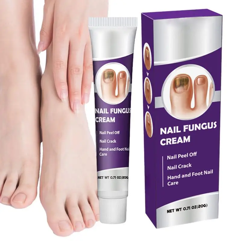 Nail Repair Cream Nail Ointment Toenail Strengthener Promotes Healthy Growth Gentle Nail Strengthening Targets Splitting Weak