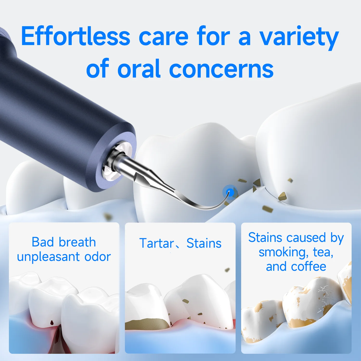 Thumbnail 3 - #31 Best Rated Ultrasonic Scalers to Buy in 2026