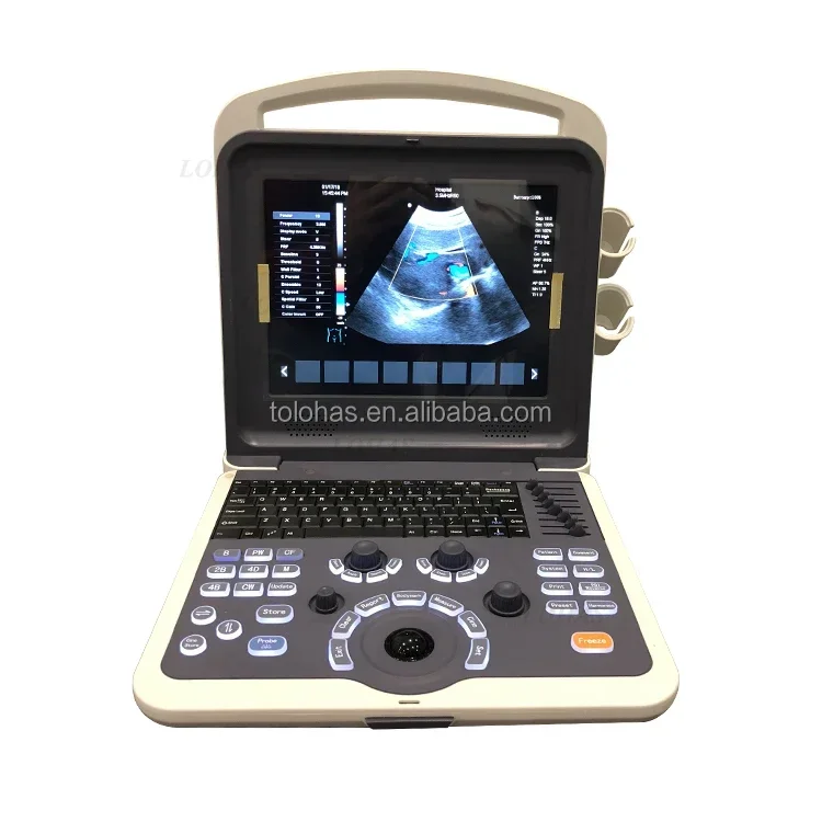 LHK2 Cheapest Portable Color Ultrasound Machine Hospital Prices of Ultrasound Machine 3D ultrasound machine price