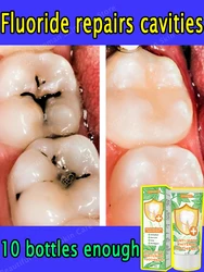 Best-selling, scientific fluoride repairs cavities, removes cavities, cleans plaque, whitens teeth, and freshens breath