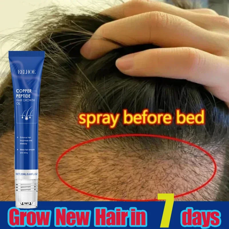 ปลูกผม ป้องกันผมร่วง ลดผมร่วง และแตกหัก