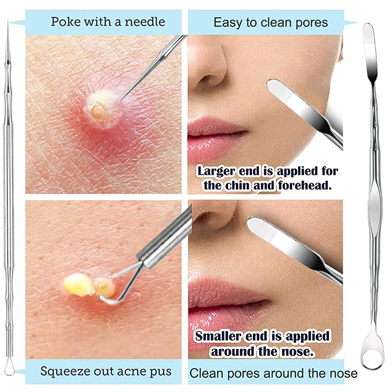 Double Head Stainless Steel Professional Blackhead Remover Blemish Extractor Tool Pimple Comedone Removal For Face