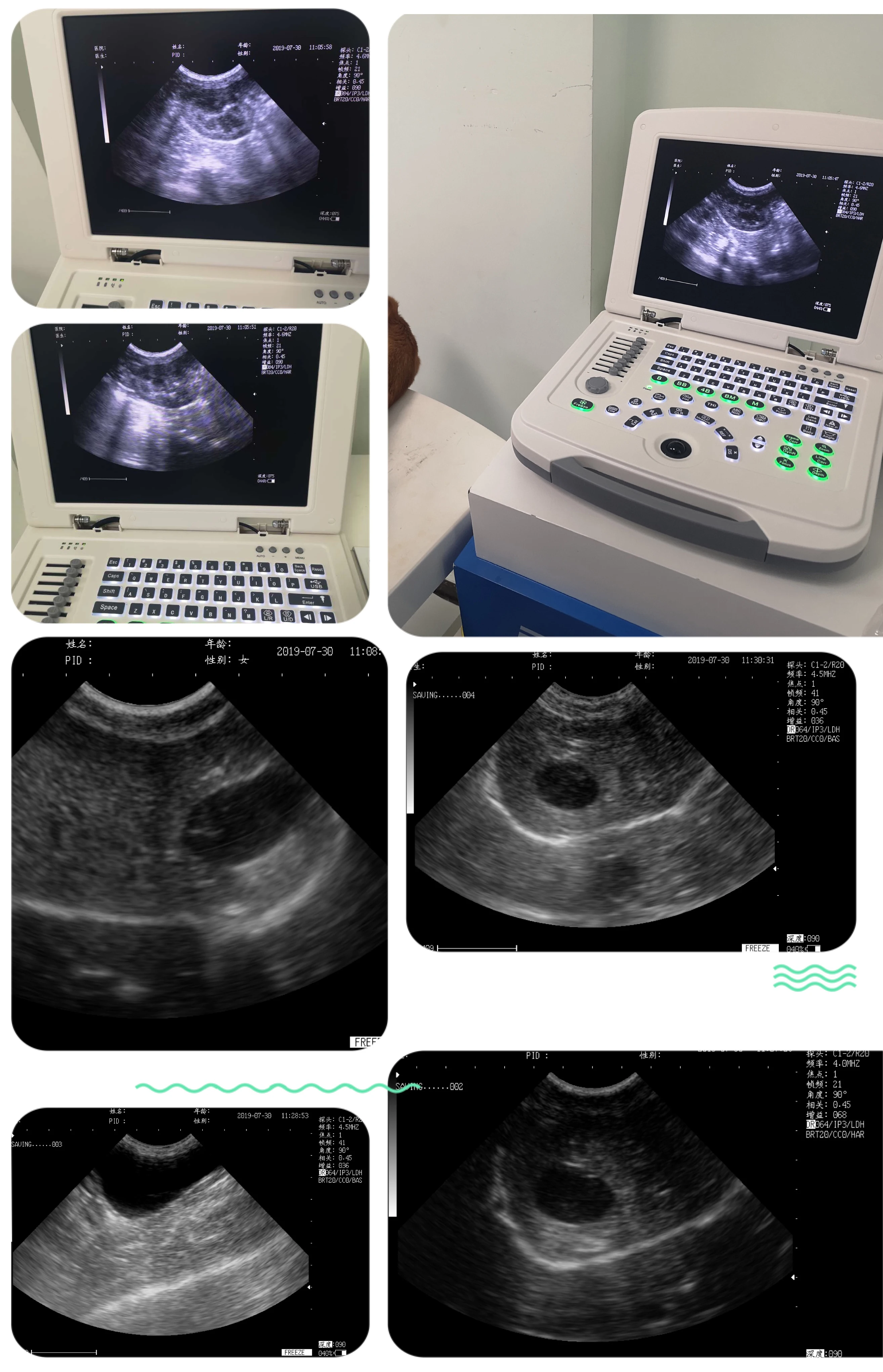 EURPET Cheap Medical Table Top Ultrasound Scanner System Ultrasound Machine With Probes Price