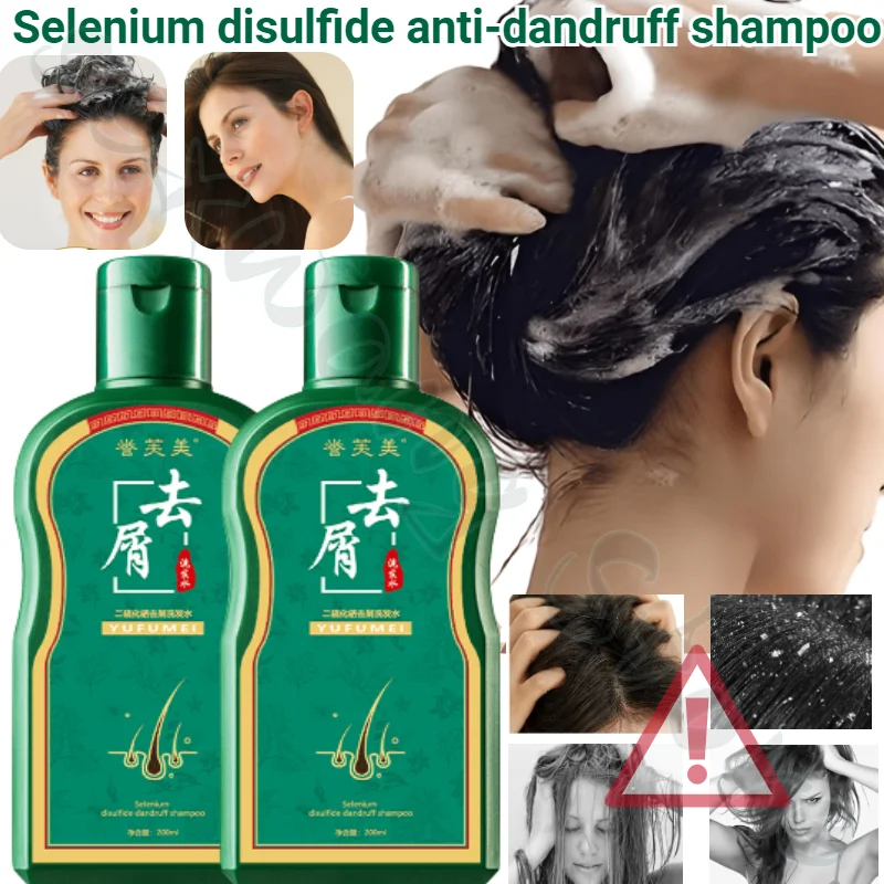 

Folliculitis Shampoo Head Itching, Antipruritic Cream, Pimple, Redness, Swelling, Seborrheic Pox Mites, Tinea Capitis, Available