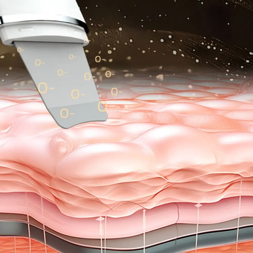 Tecnologia de íon purificador ultrassônico da pele limpeza profunda do rosto levantamento facial ultra-sônico peeling dispositivo cuidados com a pele recarregável usb