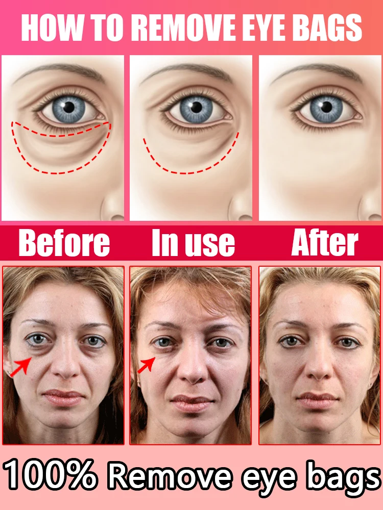 Eye Cream Anti Aging Wrinkle Remove Dark Circles Eye Bags Moisturizing Repair Soothe Puffiness Skin Care 