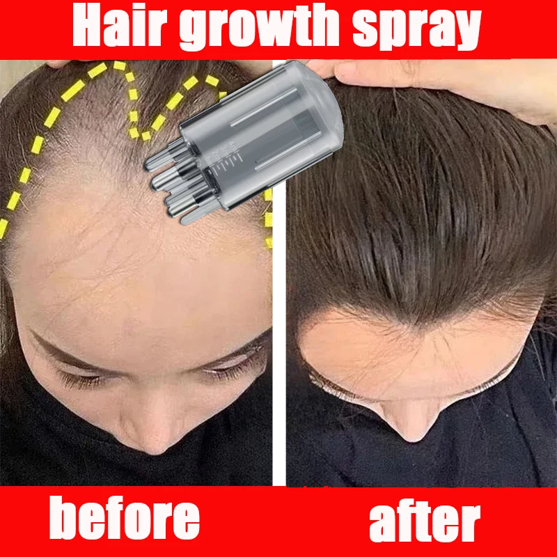 

Роликовый массаж головы с эфирным маслом для волос