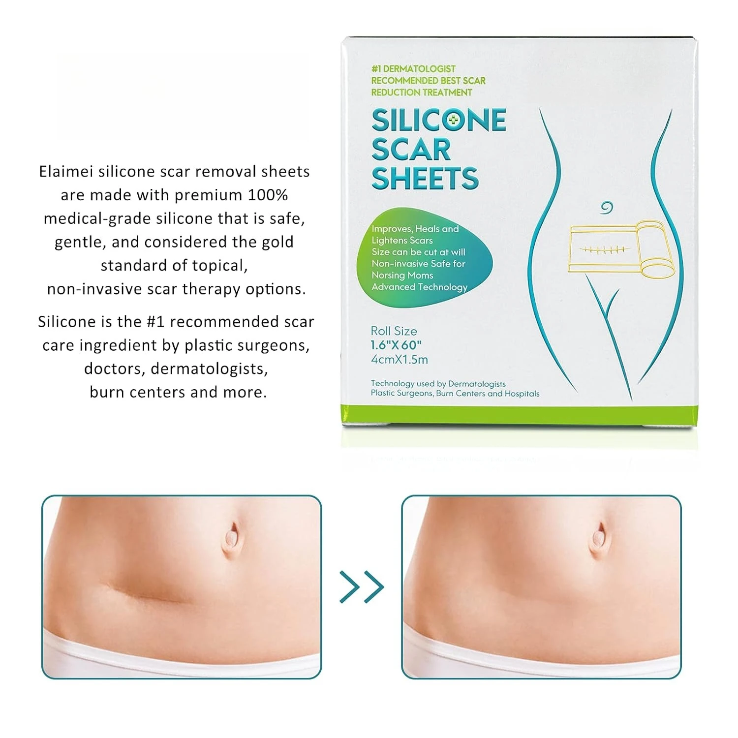 Grade Silicone Scar Sheets, Silicone Scar Tape (1.6”x 60”), Scar Removal Strips for Acne Scars C-Section & Keloid Surgery Scar