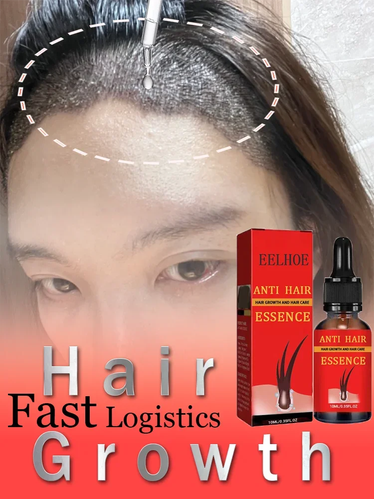 Prevent shedding, reduce hair loss, hair growth,