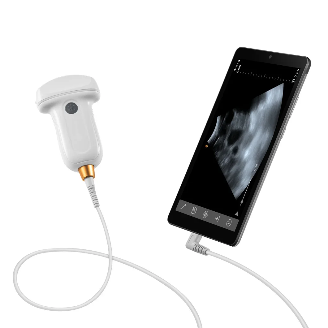 Higher Sensitivity Economic Portable Handheld Type C USB Equine Veterinary Ultrasound Probe