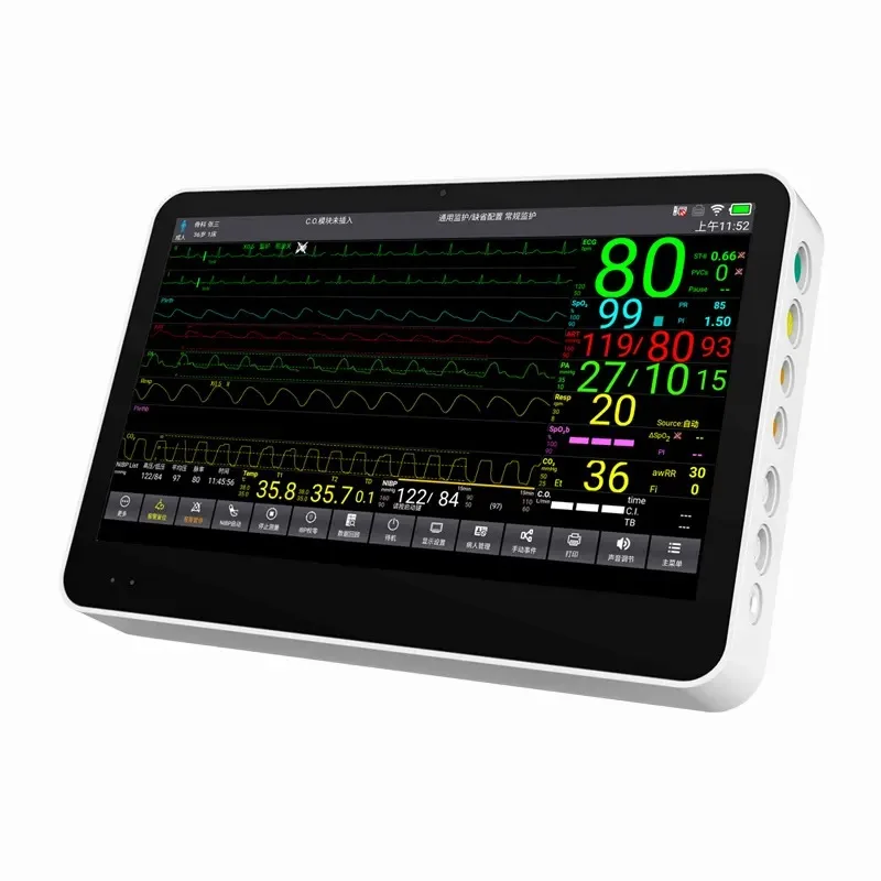 2026 Veterinary Heart Monitor Vet Multi Parameter Patient Monitor Hospital Clinic Equipment for Animal Care and Supplies