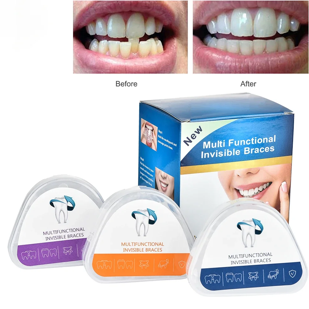 Aparatos dentales de 3 etapas, entrenador de dientes para adultos, soporte de alineación de ortodoncia, Corrector transparente, accesorios de dentista