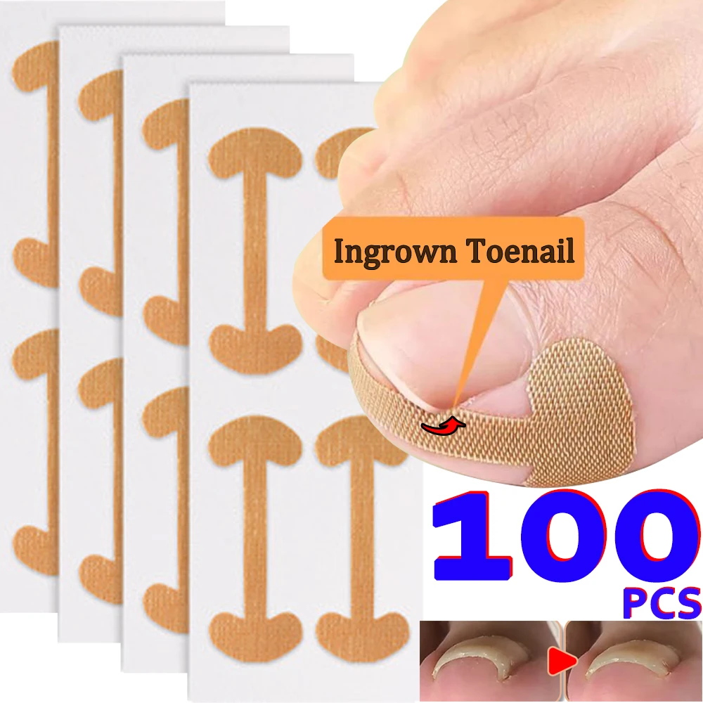 100pcs Nail Correction Stickers Waterproof Ingrown Toenail Correction Strips Anti Infection Nail Treatment Patch Health Toe Care