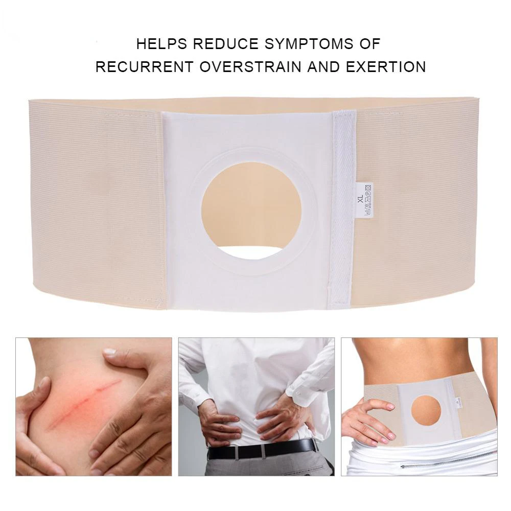 

1 Pcs Adjustable Ostomy Abdomen Belt Medical Unisex Ostomy Hernia Prevention Care Stoma Rehabilitation Pressure Band Pain Relief