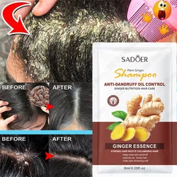 Anti-Dandruff Anti-Itch Shampoo Fast Cleaning Repair Scalp Treatment Products Oil Control Antibacterial Mite Hair Care Men Women