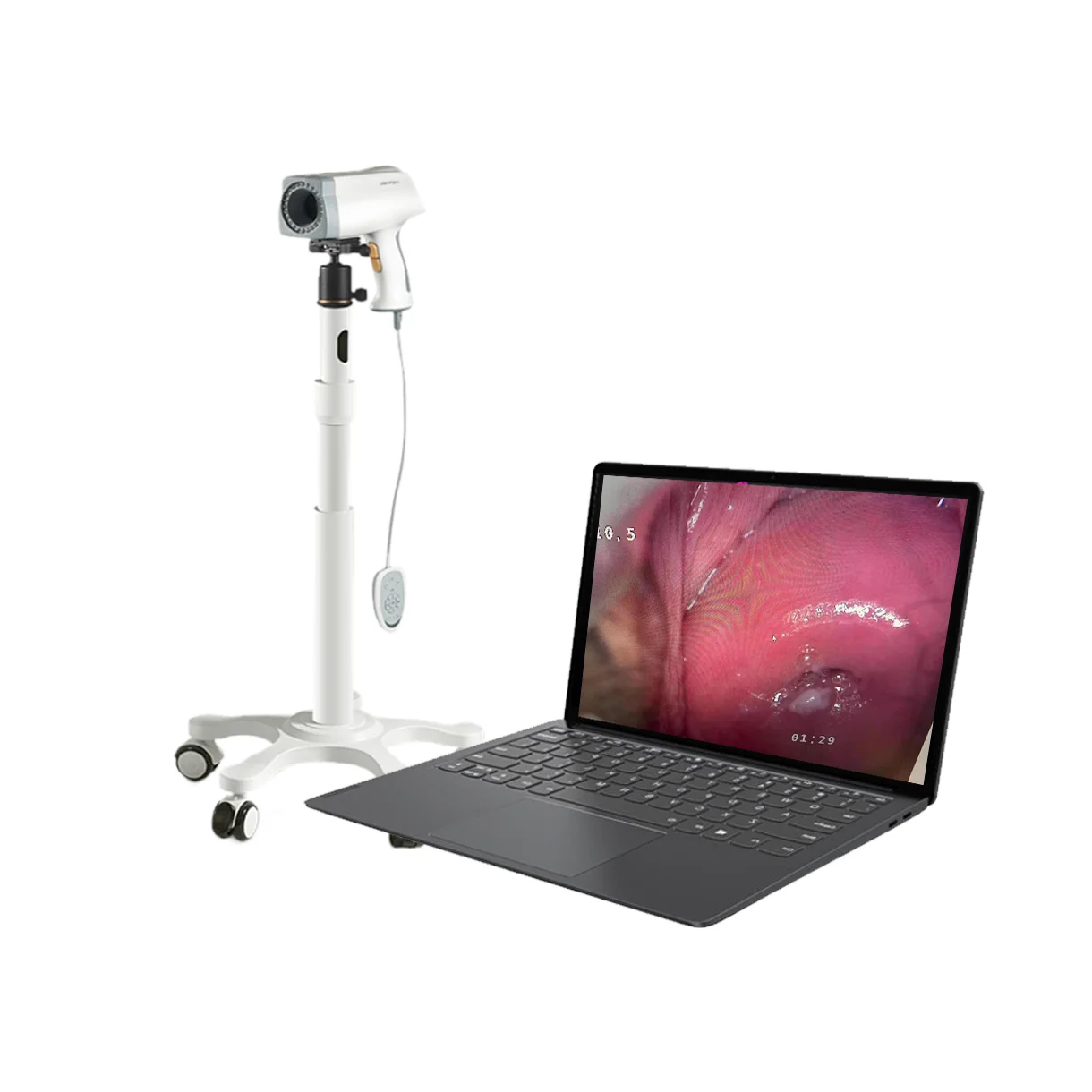China Video Colposcopio Digital Goldway Precio Mini Camara inalámbrica Ginecología Precio Portatil Usb Colposcopio médico