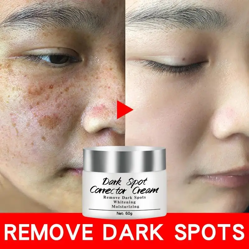 Newest Dark Spots Corrector Cream Whitening Facial Cream Repair Fade Freckles Remove Dark Spots Melanin