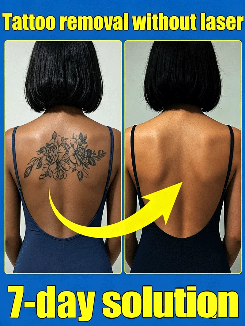 Efficient Pigment Fading Permanent Tattoo Remover