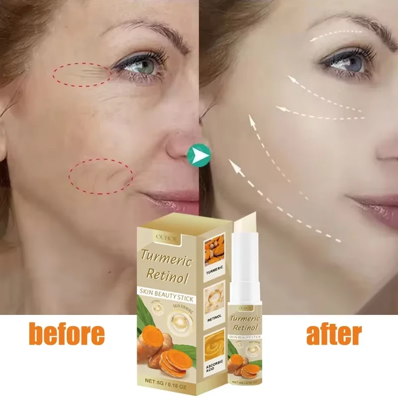 

Instant Wrinkle Removal Face Balm Stick Retinol Anti Aging Lift Firming Fade Fine Lines Moisturizing Whitening Repair Skin Care