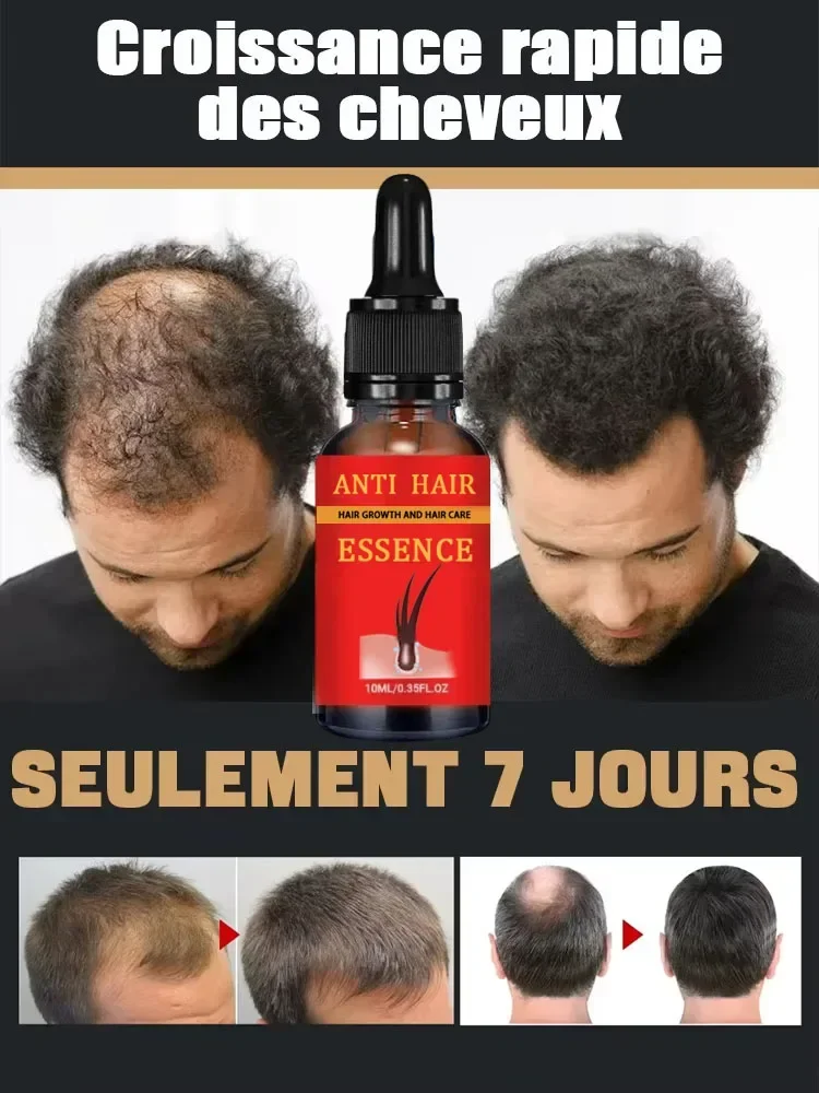 2 Hot sale,  hair is getting more and more, say goodbye to baldness, sparse hair starts to become thick buyers will buy again,