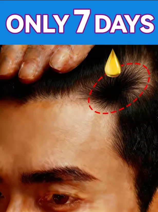 Biotin Hair Growth Spray Oil Products Care Scalp Massage Treatments Anti Hair Loss Effective Grow Thicker Hair Serum for Men